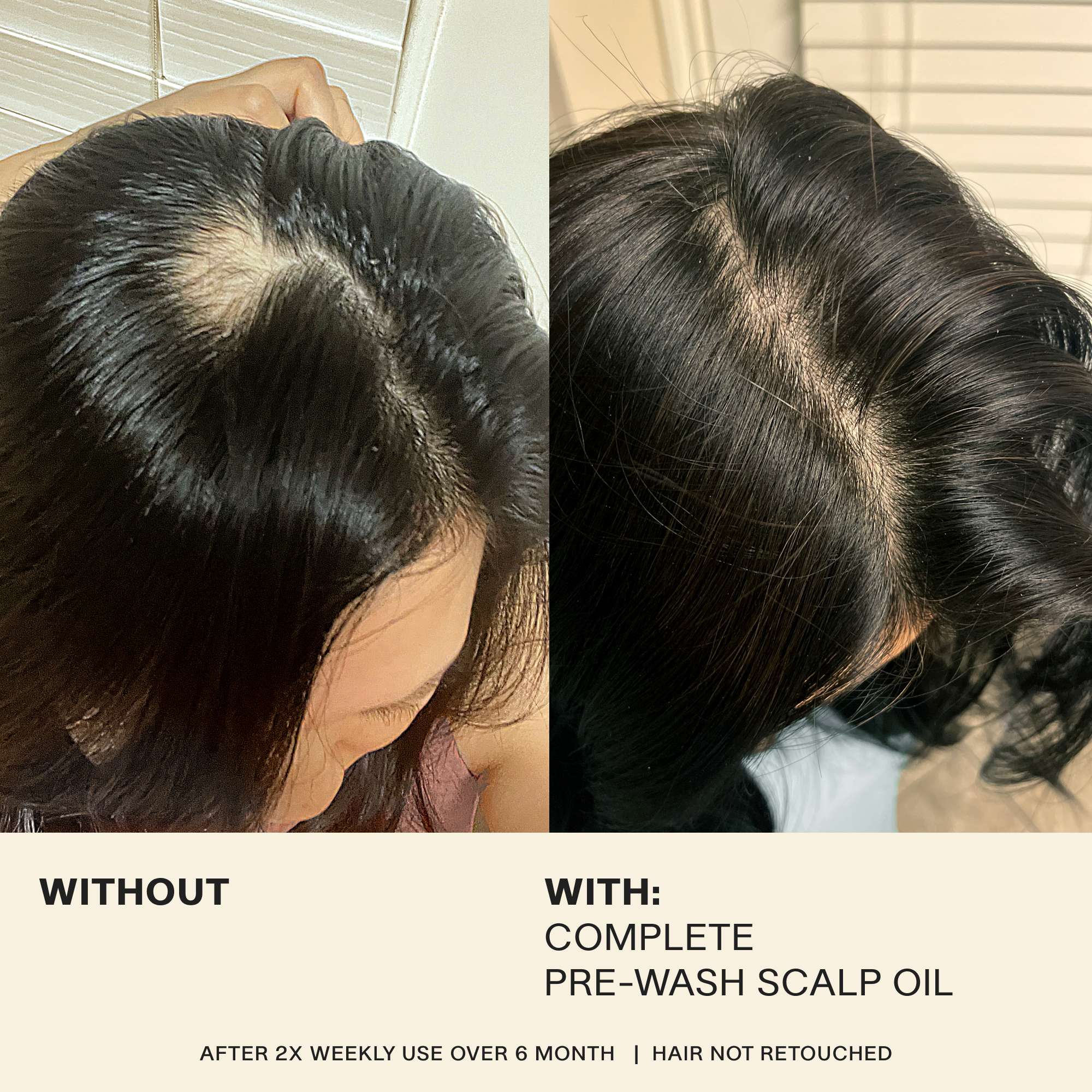 Complete Pre-Wash Scalp Oil - Image 4