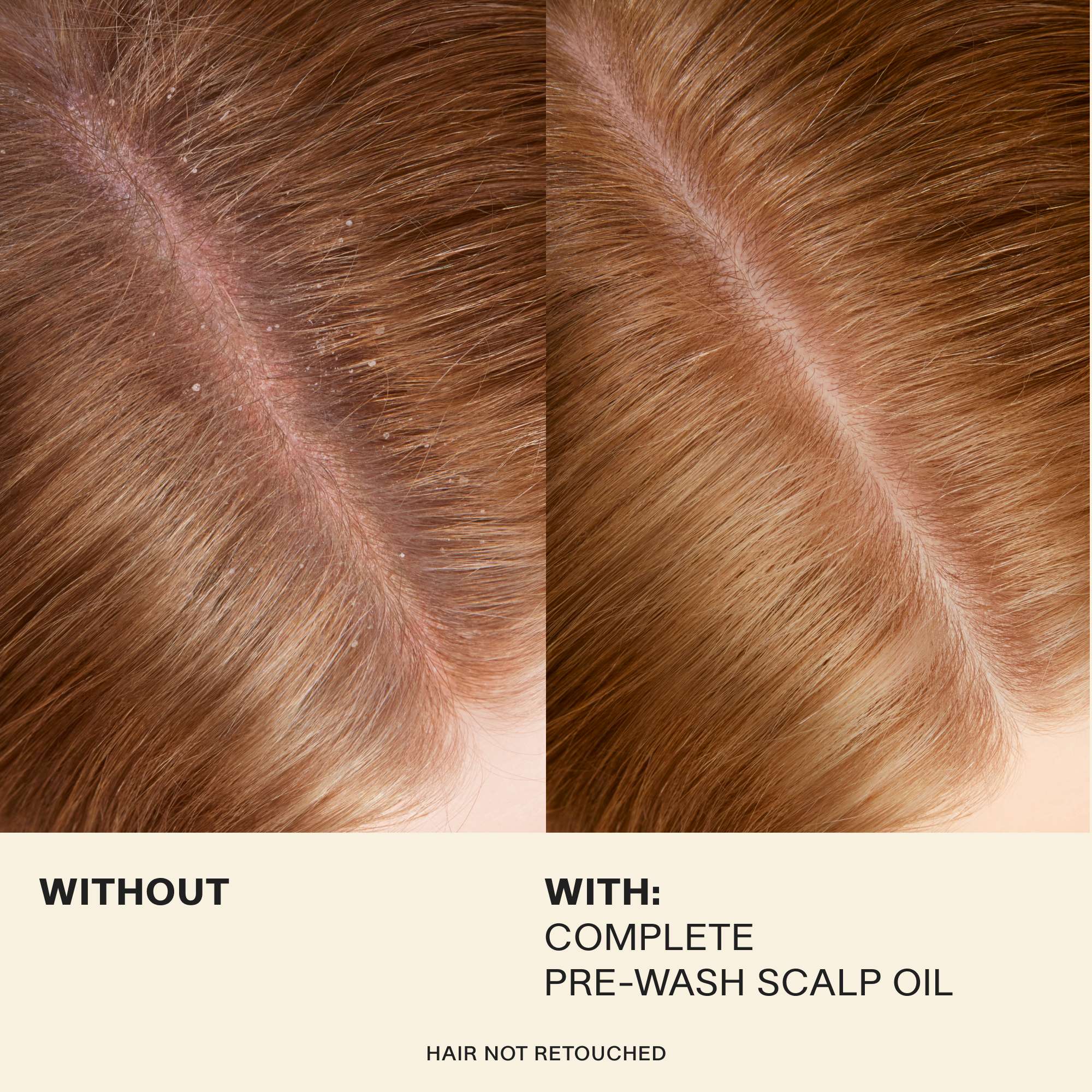 Scalp Massage Moments (3-Pack) - Image 5